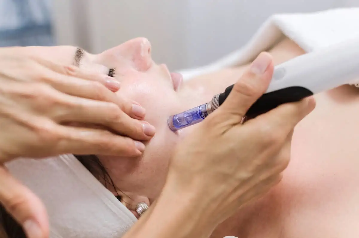 SkinPen Microneedling by Glowtox in New York